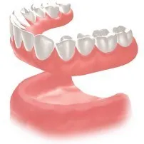 従来の総入れ歯での治療方法　柴垣歯科医院