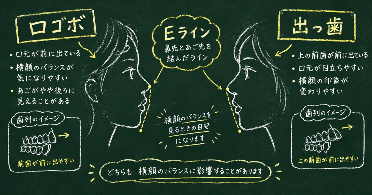 口ゴボと出っ歯はどう違う？口元の見た目でわかる特徴