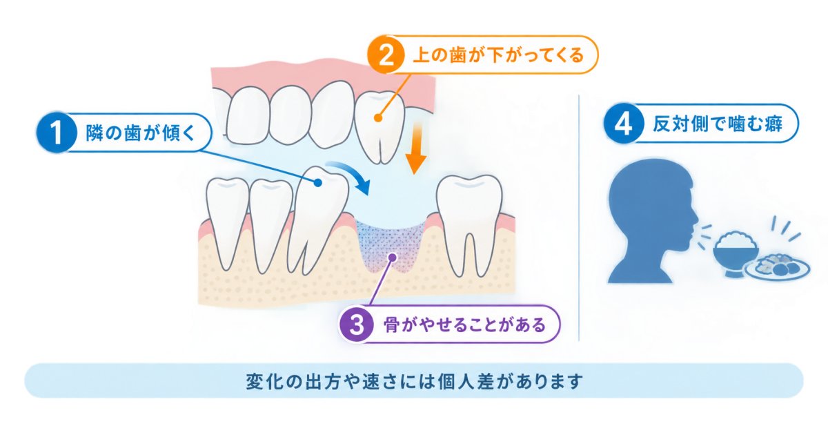 奥歯が抜けっぱなしだと、半年でどんな影響がありますか?