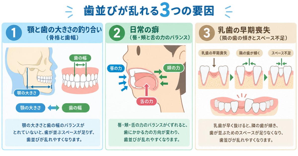 歯並びが乱れる原因は「生まれ持った特徴・日常の癖・歯の喪失」の3つに分けて考える