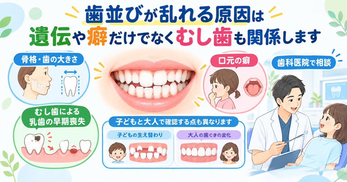 歯並びが乱れる原因は遺伝や癖だけでなくむし歯も関係します